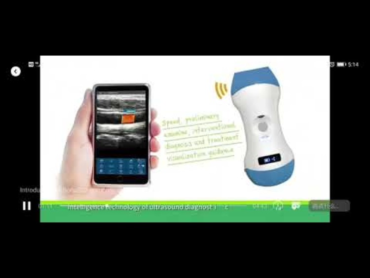 Sonostar Technologies Co., Limited