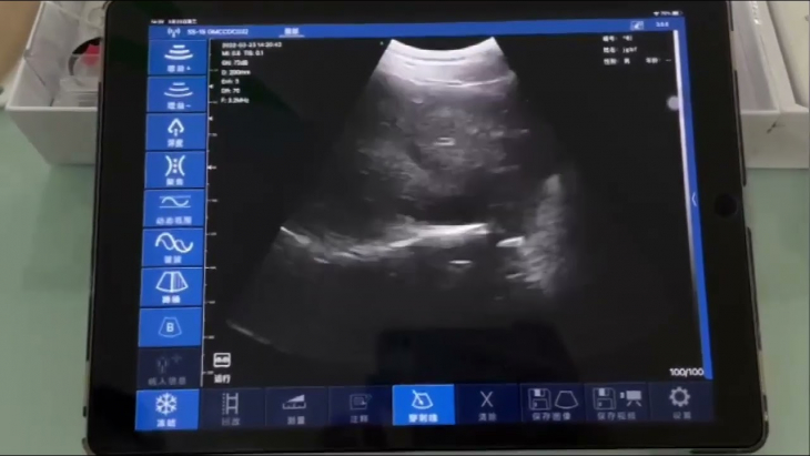 convex palm B/W ultrasound machine